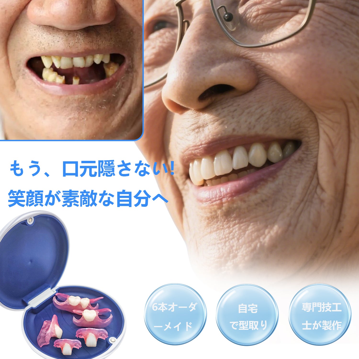 6本 カスタム 入れ歯 部分 取り外し可能 Dentellea 義歯 携帯便利 自然