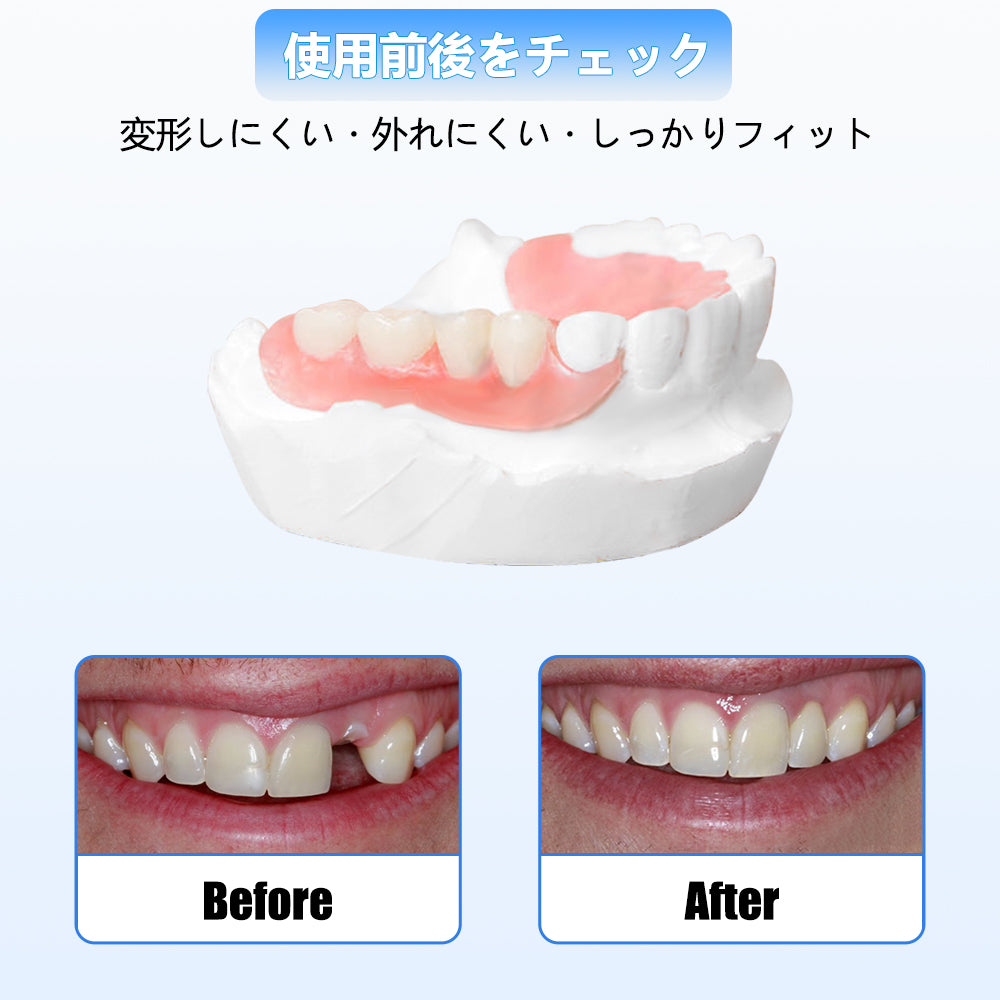義歯を1本追加するごとに費用は4,000円となります。