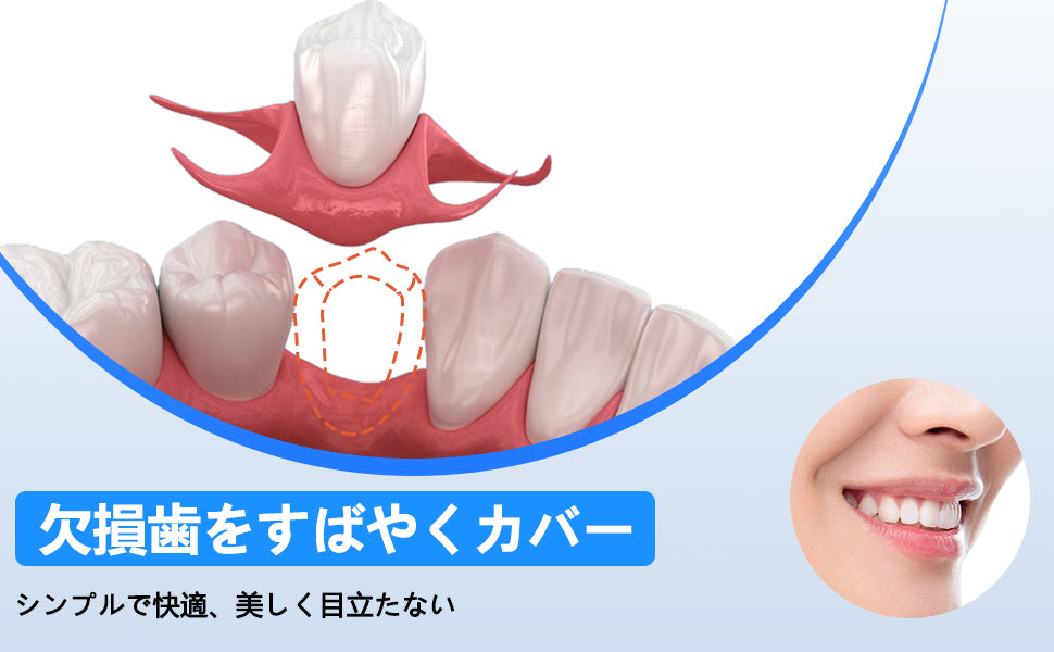 1本 カスタム 入れ歯 部分 取り外し可能 Dentellea 義歯 携帯便利 Amazon.co.jp: 1本 カスタム 入れ歯 部分 取り外し可能