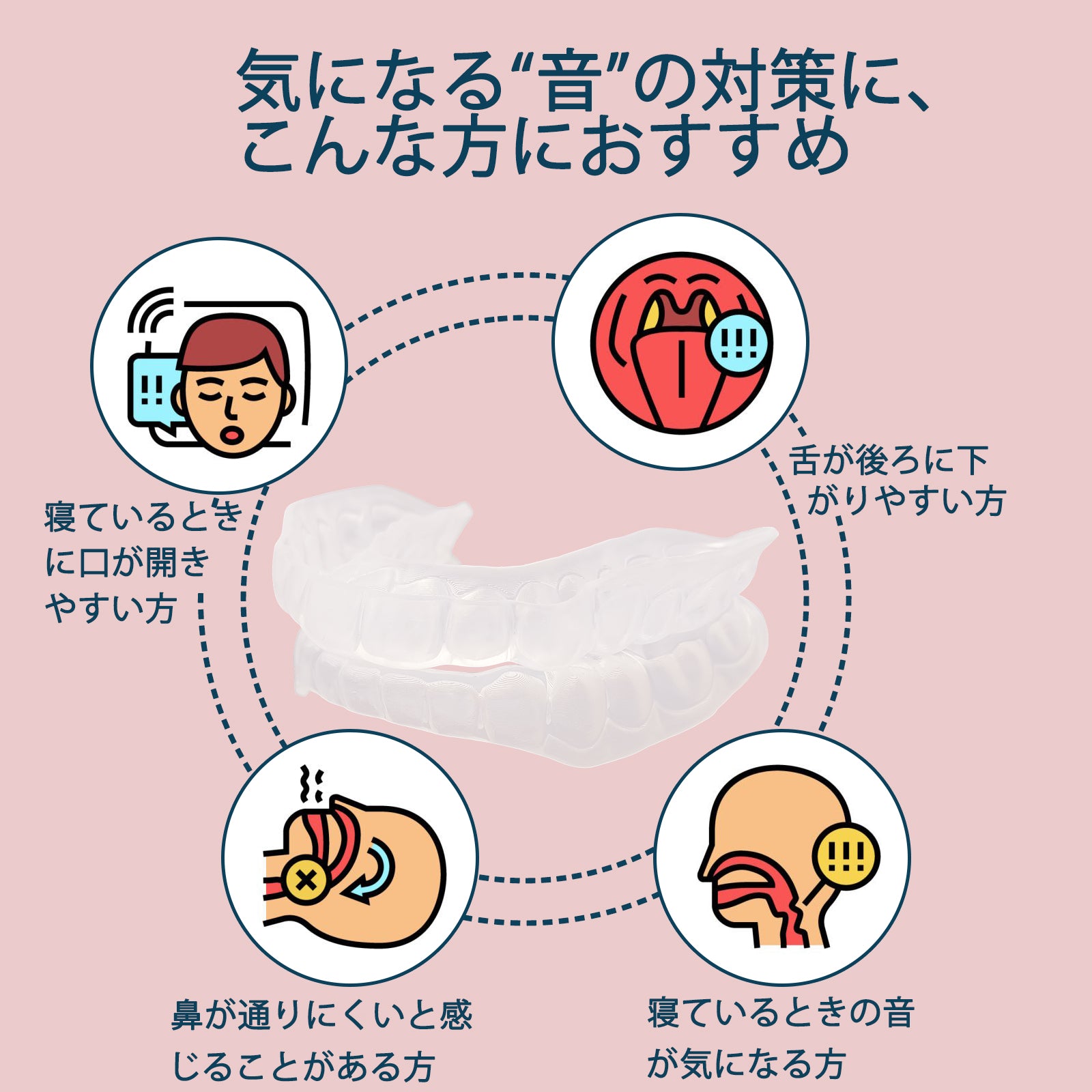 カスタムフィット仕様】Dentellea マウスピース いびき ナイトガード