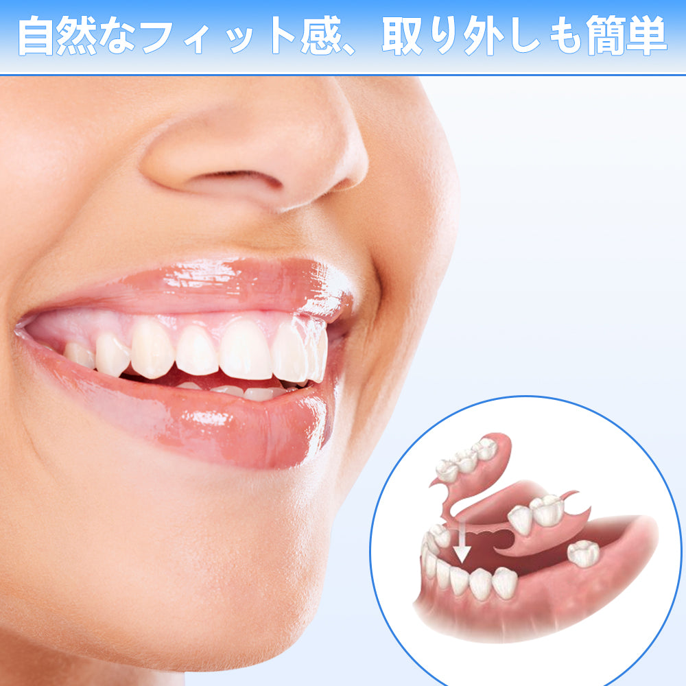 5本 カスタム 入れ歯 部分 取り外し可能 Dentellea 義歯 携帯便利 自然