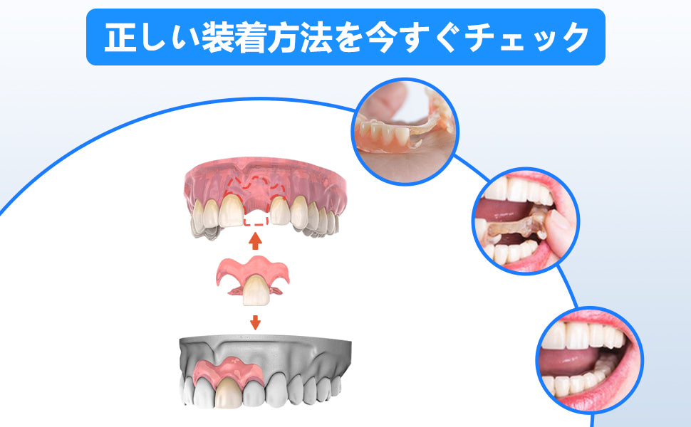1本 カスタム 入れ歯 部分 取り外し可能 Dentellea 義歯 携帯便利 Amazon.co.jp: Dentellea カスタム 入れ歯 部分 取り外し可能